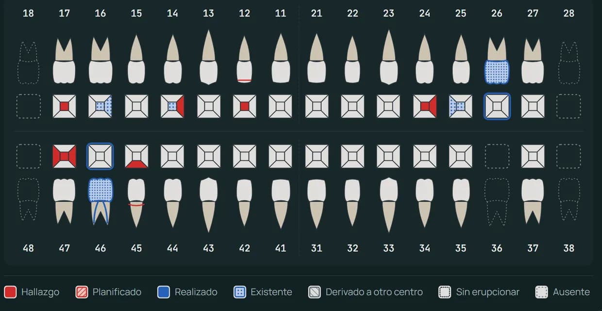 Odontograma de una paciente de ejemplo con hallazgos, trabajos realizados y piezas ausentes