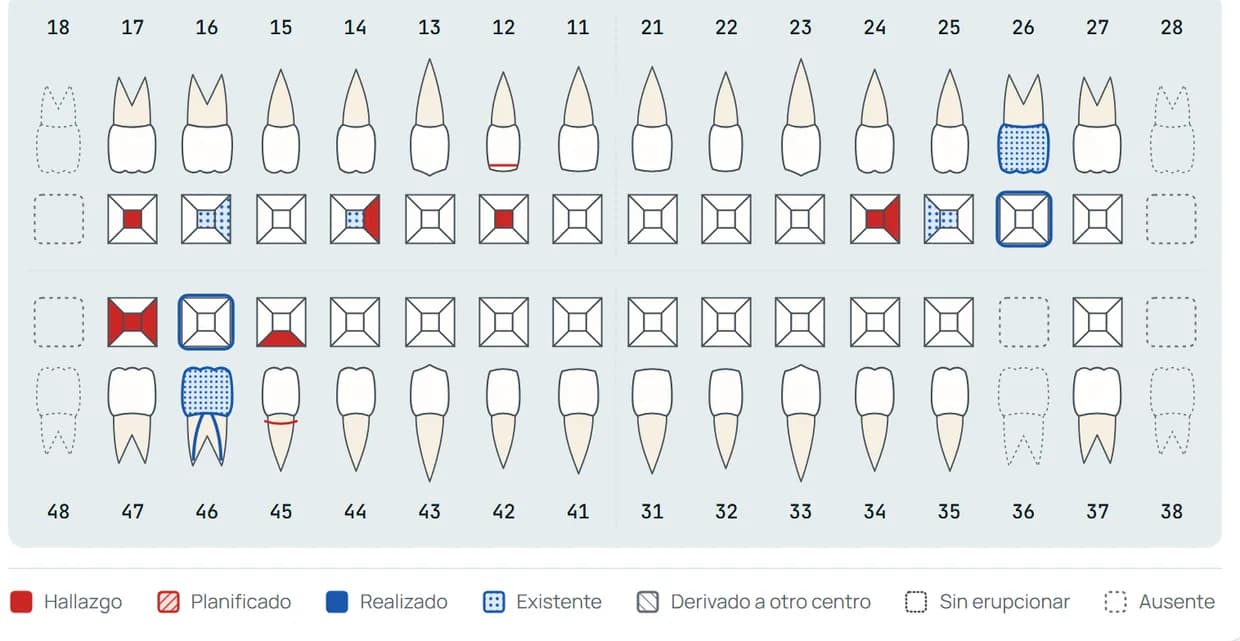 Odontograma de una paciente de ejemplo con hallazgos, trabajos realizados y piezas ausentes